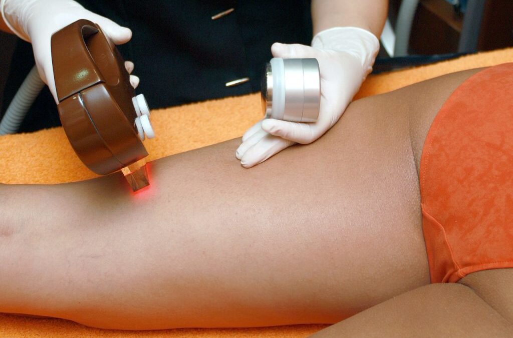 Tips for Laser Hair Removal
