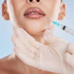 lip-fillers-aftercare-10-tips-what-to-expect-and-more
