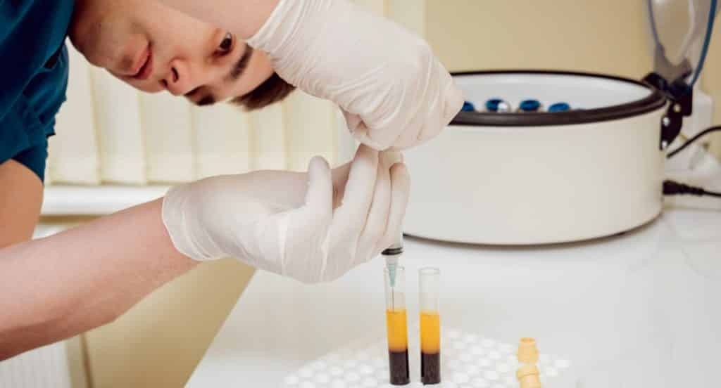 prp-vs-prf-whats-the-difference