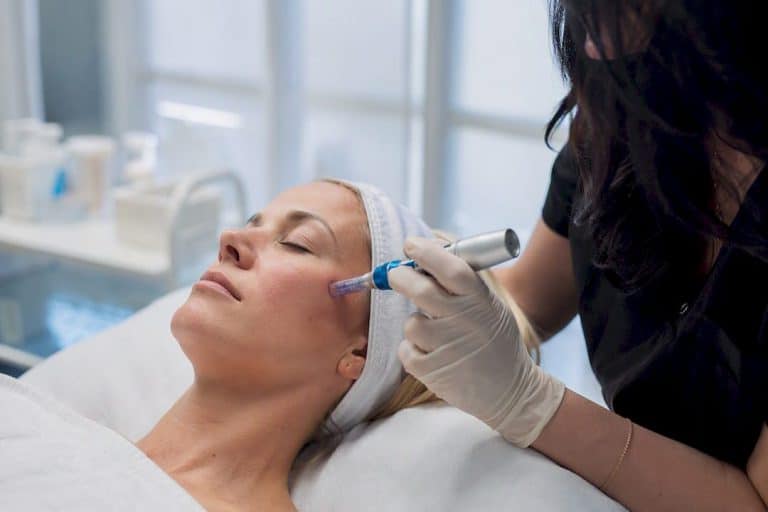 Close-up of microneedling device on facial skin