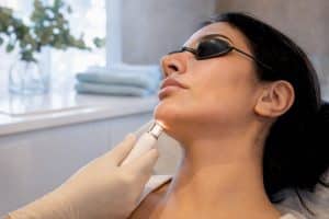 Laser hair removal treatment for facial hair