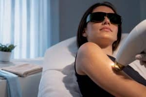 Laser hair removal treatment on upper arm