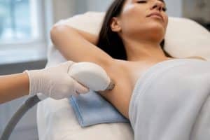 Clinician performing underarm laser hair removal