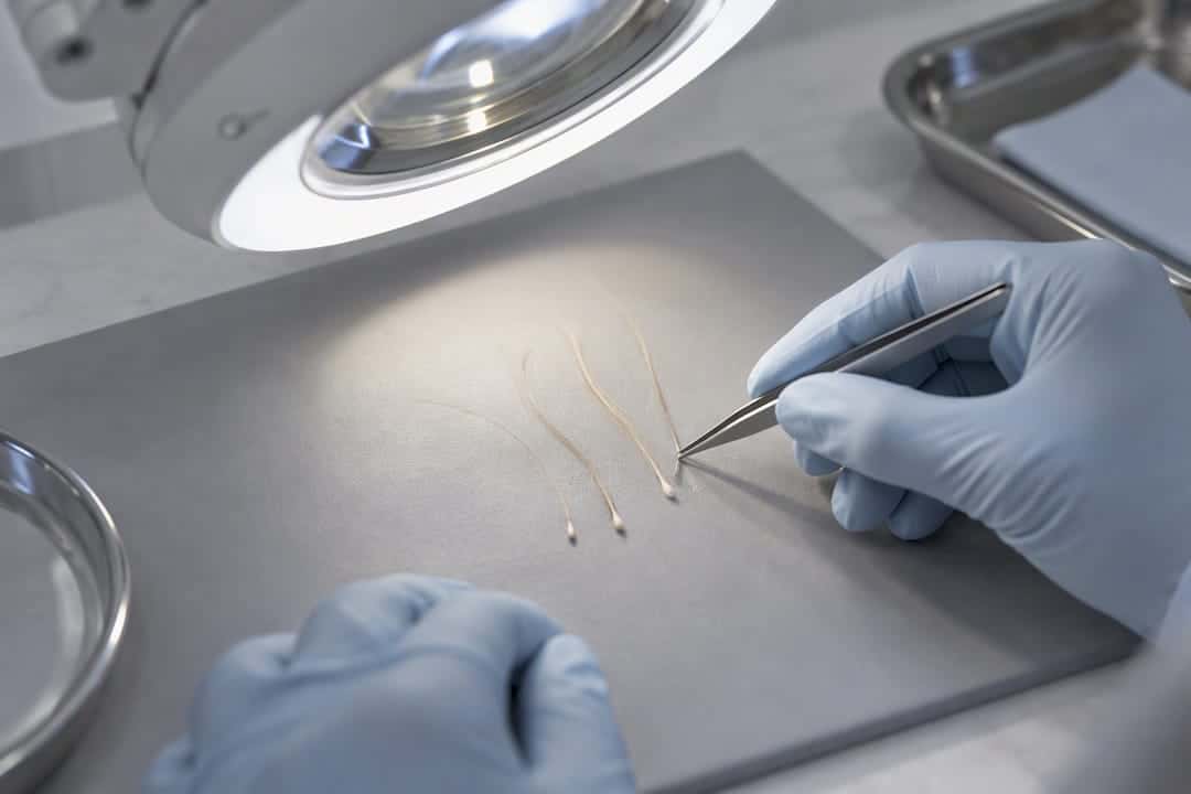 Clinician inspecting blonde hair roots