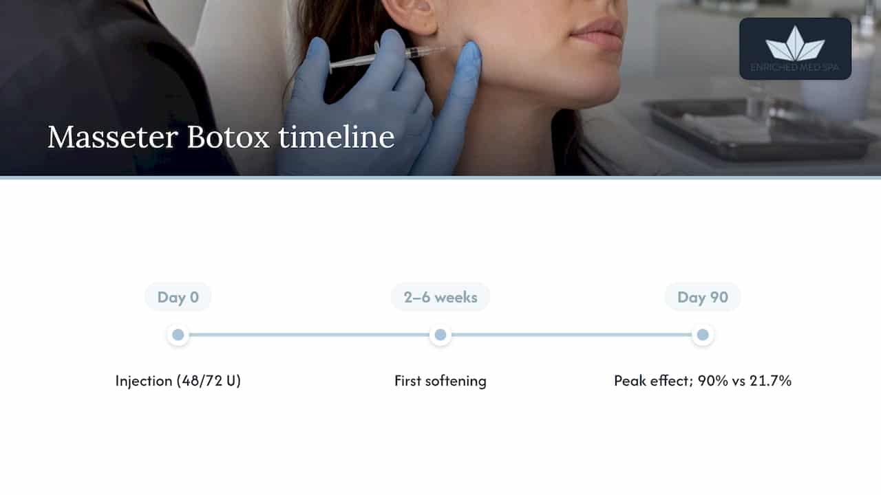 Masseter Botox improvement timeline to day 90