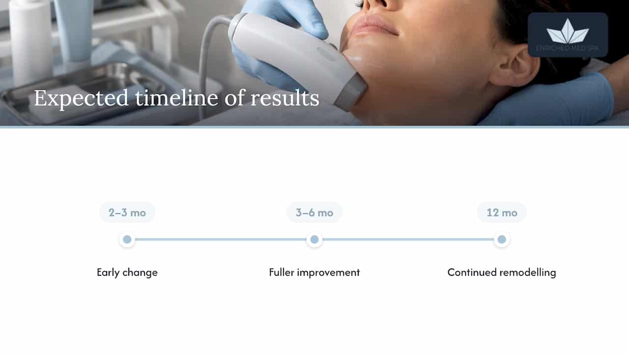 Timeline of skin tightening results over one year