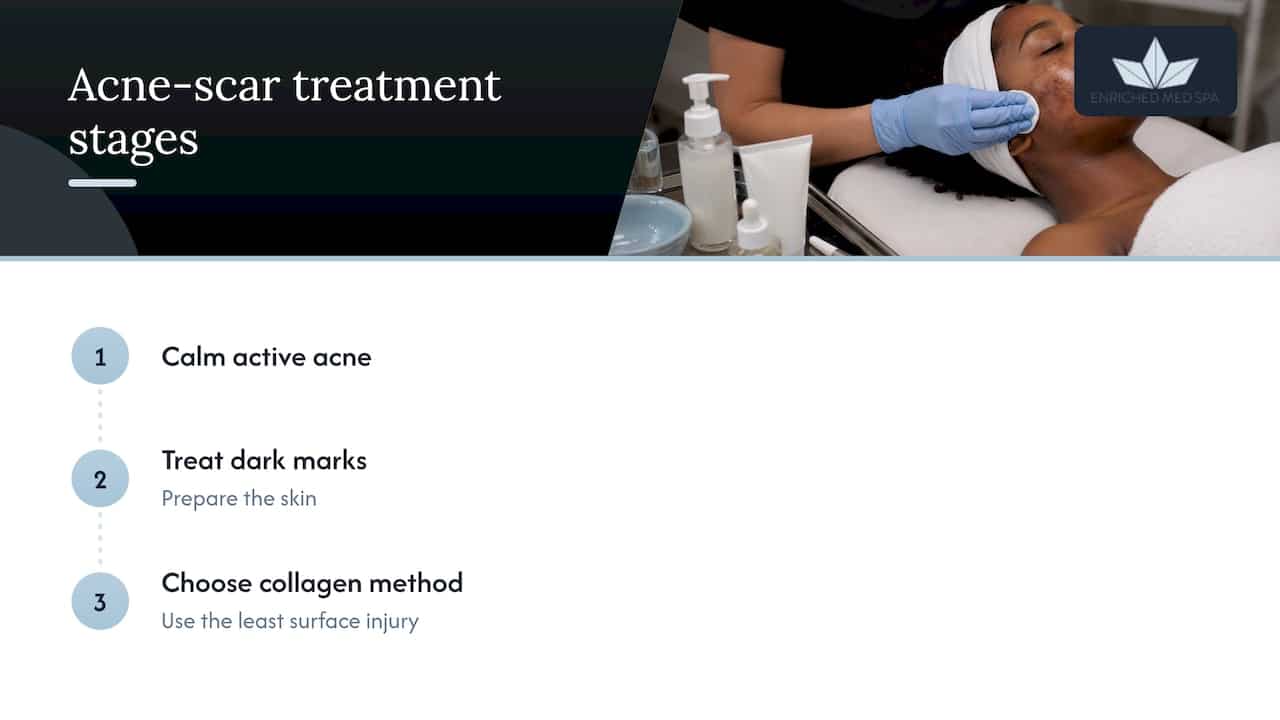 Three stages of a cautious acne scar plan